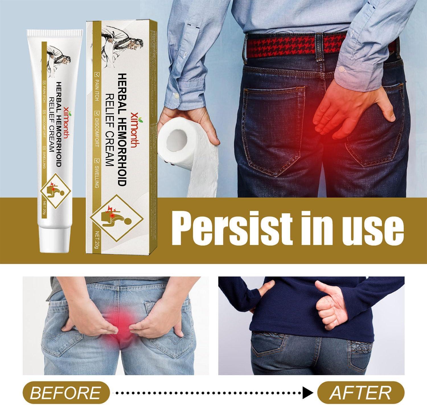 Natural Herbal Hemorrhoid Cream Hemorrhoid Cream Hemorrhoids Ointment Anal Cream Natural Healing