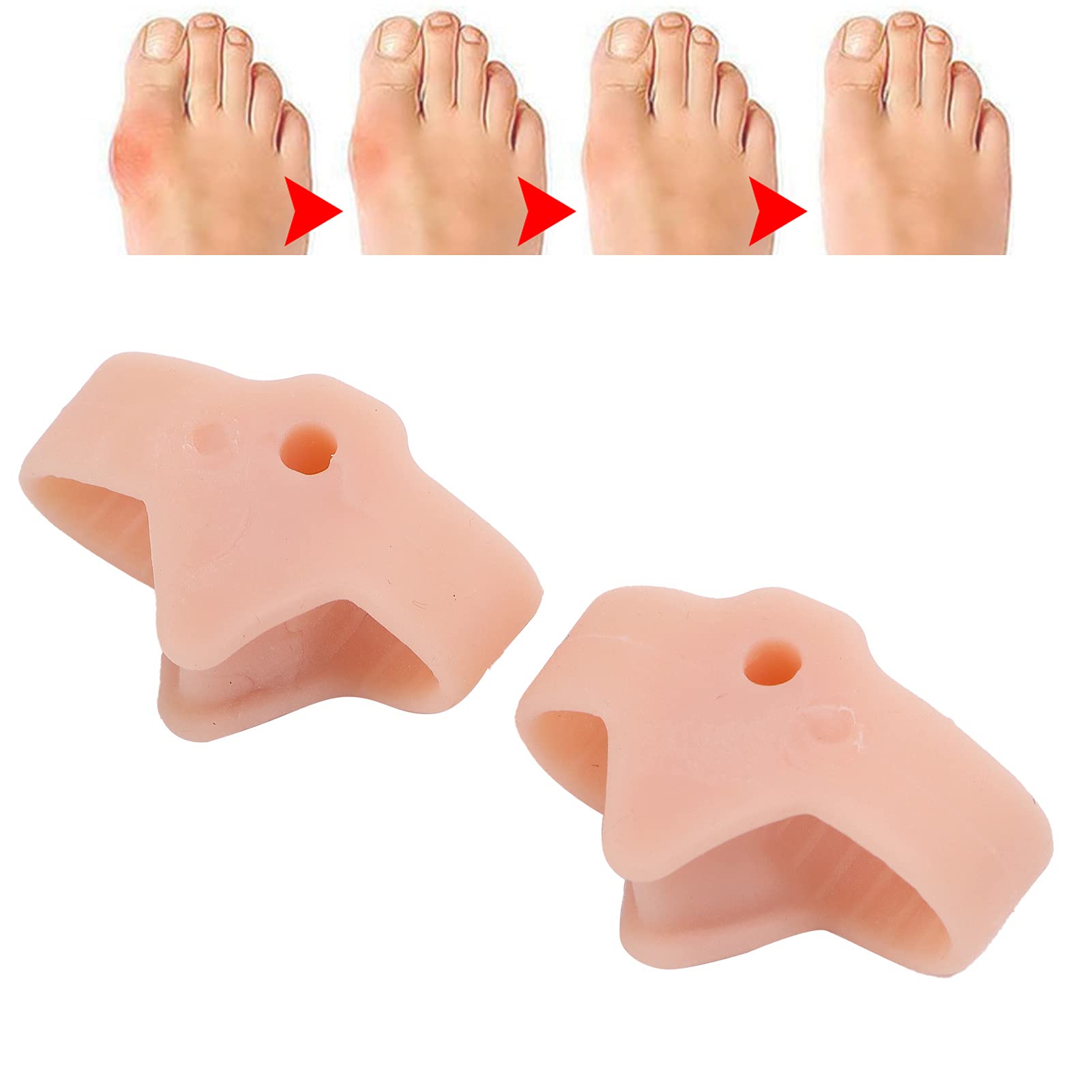 Silicone Bunion Corrector Orthotic Toe Separators Bunion Pads Big Toe