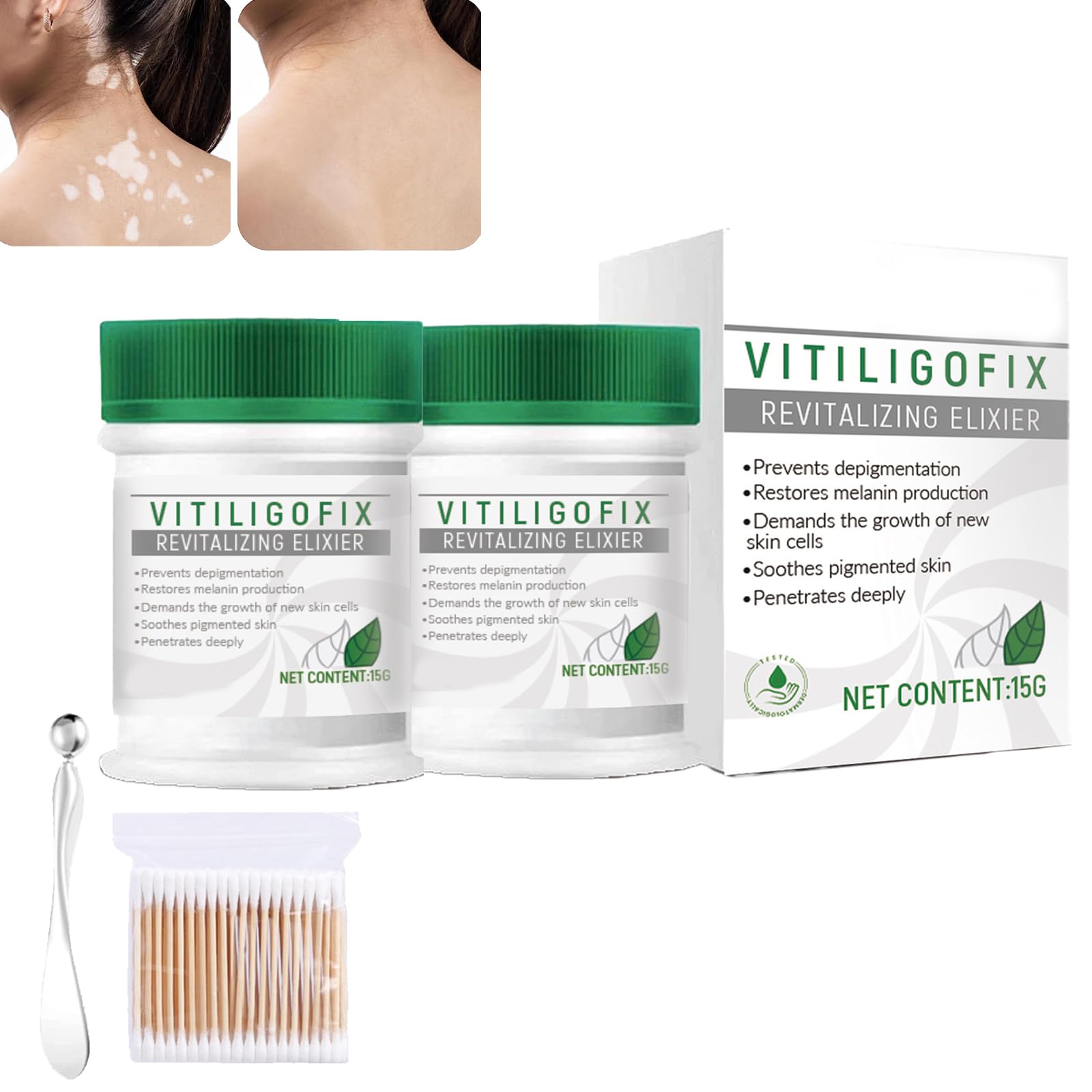 Vitiligo Fix Revitalize Elixir Soothing Cream Set Skin Treatment Vitiligo Fix Revitalize Elixir Soothing Cream Set Skin Treatment