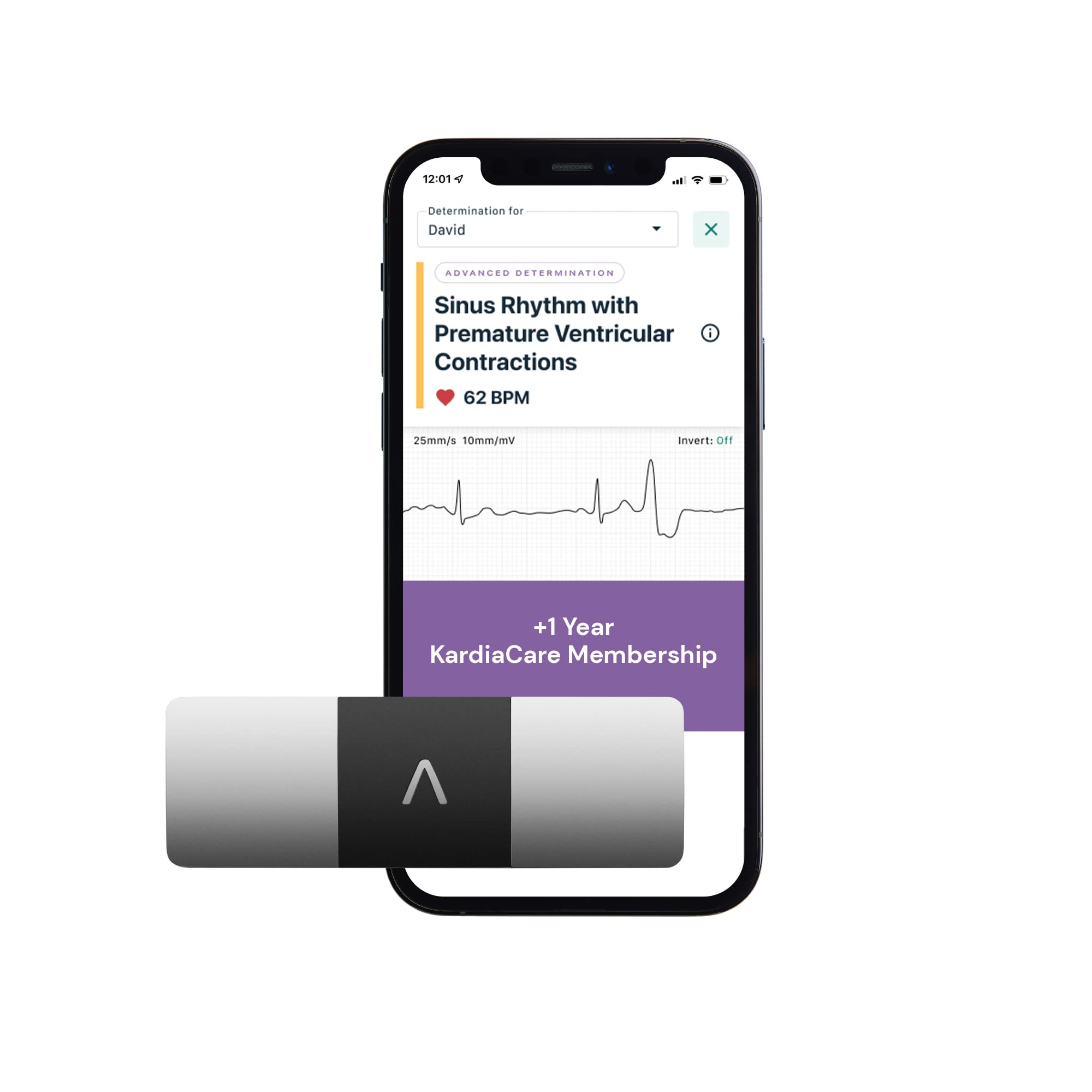 AliveCor KardiaMobile 6L is a 6 channel ECG in pocket size