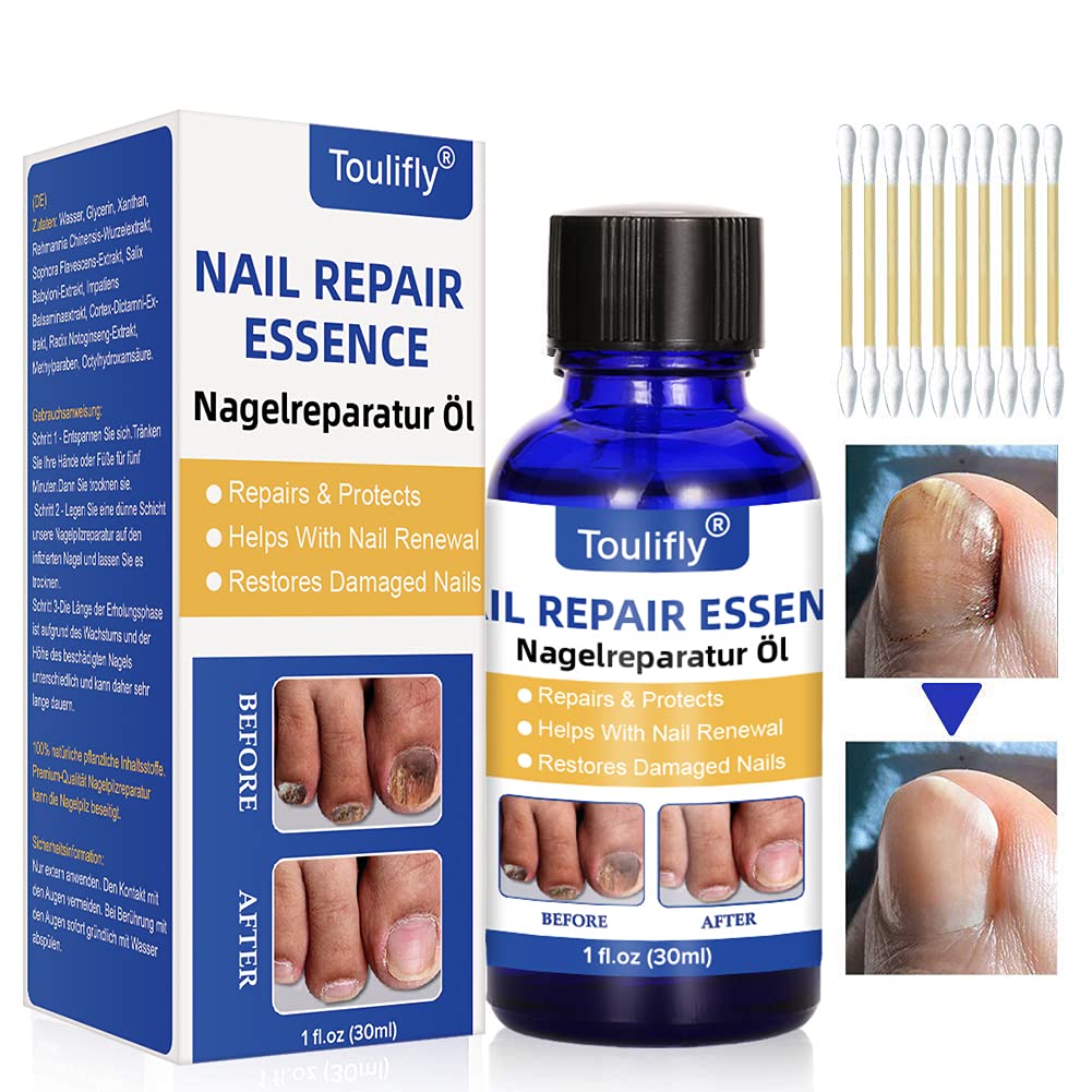 Nail Tek Repairs Damaged Nails kit.Intensive  Therapy(.5OZ),Foundation(.5OZ)& Renew(.48OZ) | Nail tek, Nail strengthener, Damaged  nails