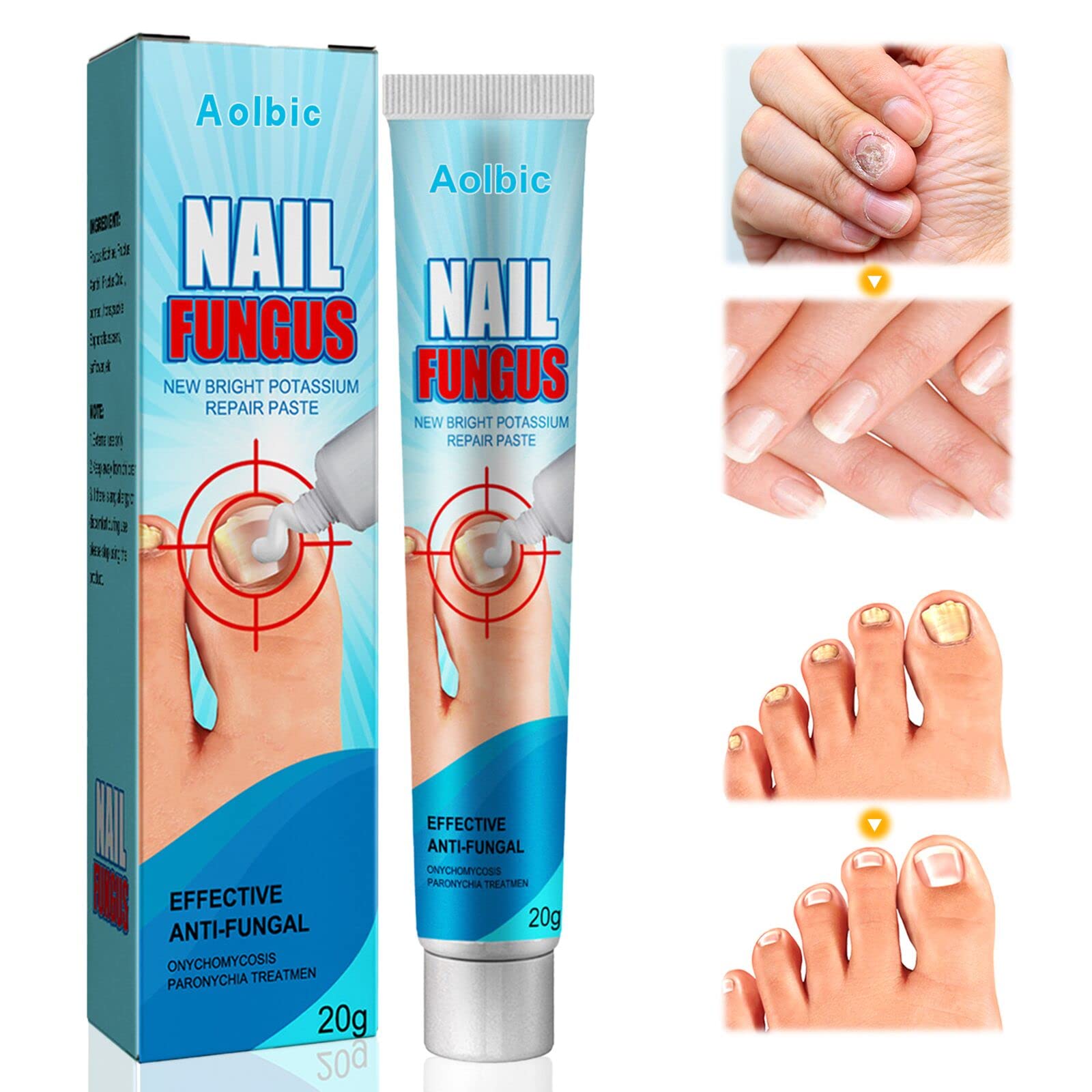 Nail Repair Cream, Effective Toenail Fungus Treatment Cream, Extra Strong  Finger & Toenail Fungus Treatment, Toenail