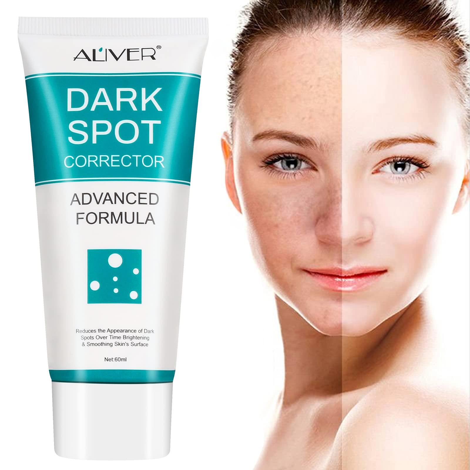Dark Spot Remover for Face Dark Spot Corrector Cream Fade Out The Skin  Black Precipitate Remove Freckle for Face Fade Spots for All Skin Tone Types