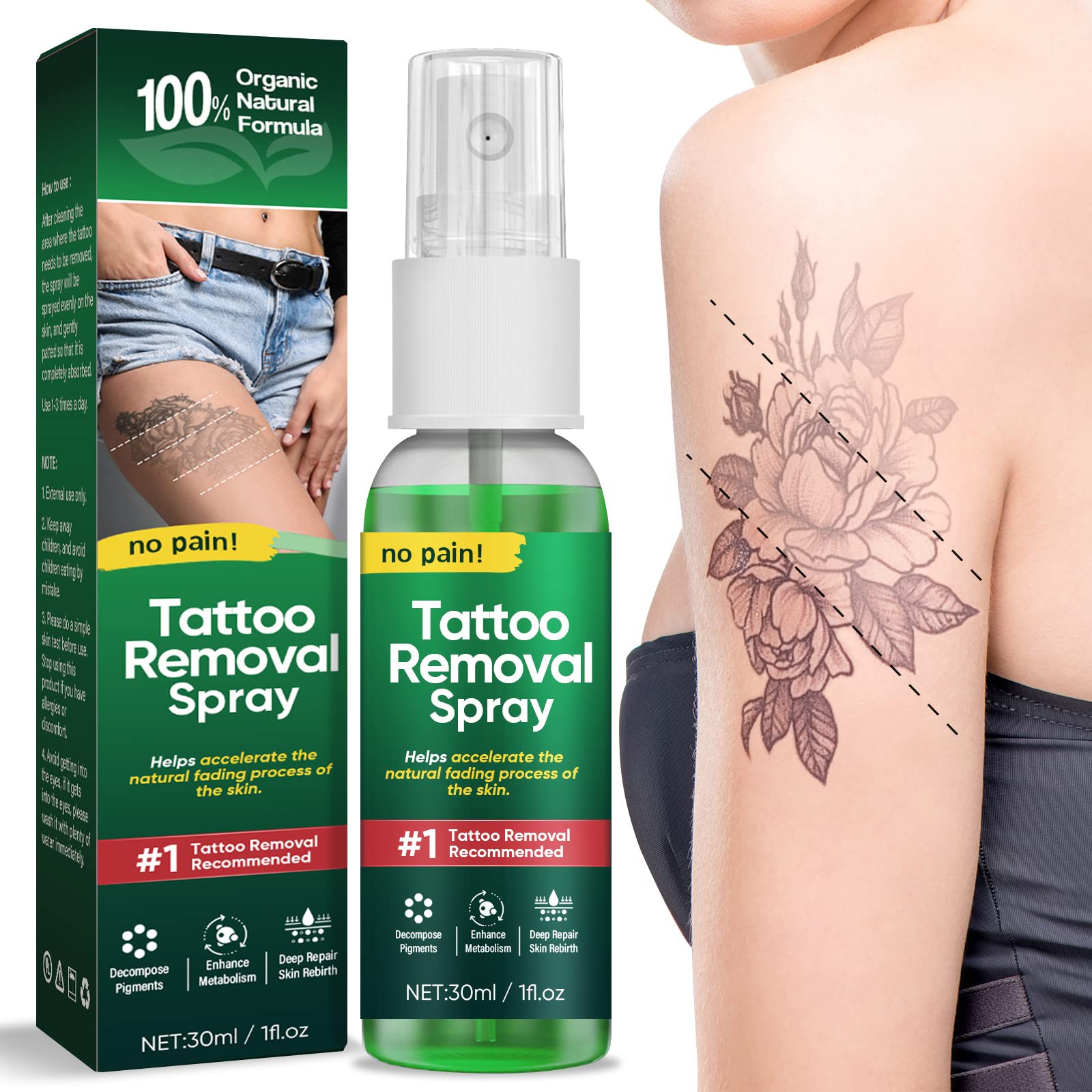 Laser Tatoo Removal - SERVICES - SKIN CARE