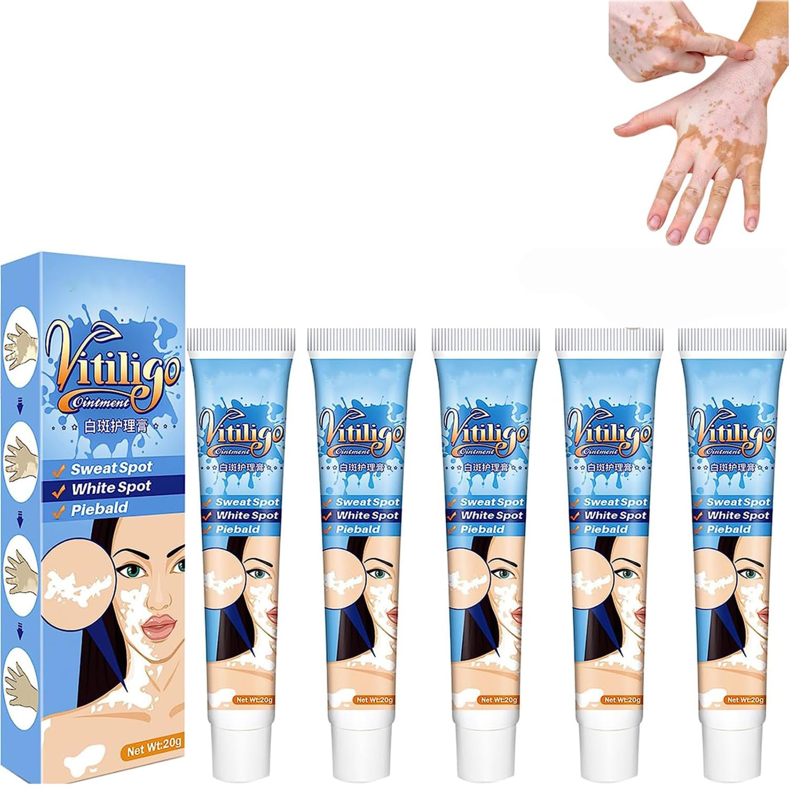 Exqst Vitiligo Therapy Cream Reduce White Spots Improve Skin Exqst Vitiligo Therapy Cream Reduce White Spots Improve Skin