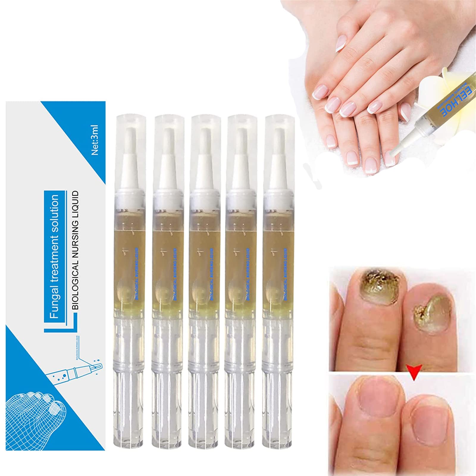 Okita Toenail Fungus Pen Nail Fungus Treatment Pen Nail Repair Pens for