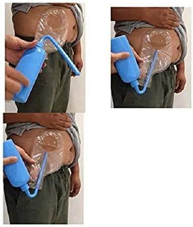 20PCS Kids Child One-piece Colostomy Bag Drainable Pouch Ileostomy Stoma  Care | eBay