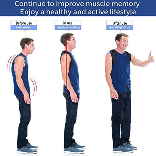 MYSEXY Posture Corrector Upper Back Brace for Women and Men Pain