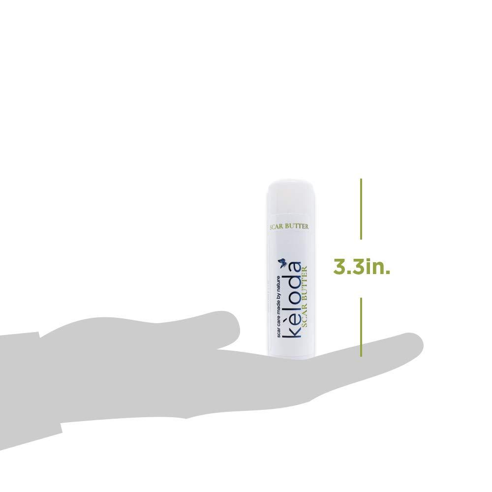 KELODA Keloid Scar Care Butter Stick Surgical Scars & Keloids Removal