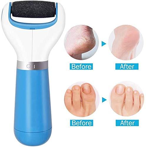 Foot Callus Remover, Electric Foot File Rechargeable Callus Dead Skin  Remover Plastic Foot Care Pedicure Tool Foot Sander Foot Care Grinding  Machine Removal Dry Hard Cracked Skin for Women Men 