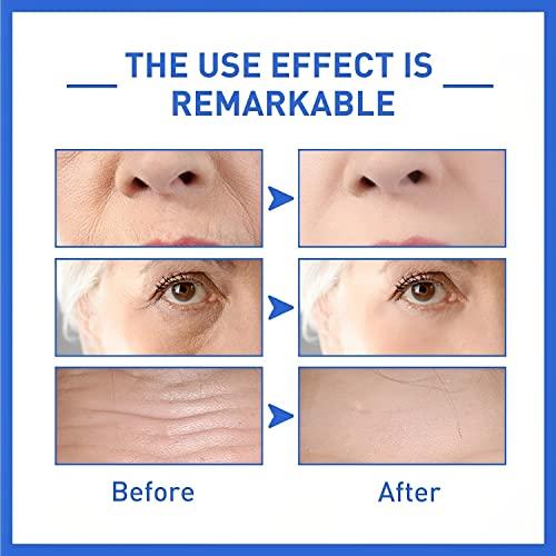 Vechten tegen donkere vlekken | La Roche Posay Pigmentclar