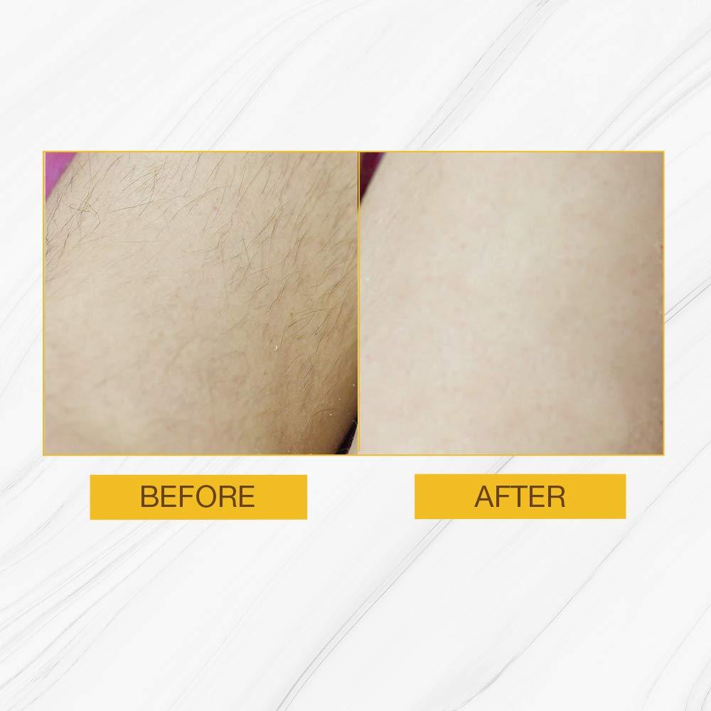 GiGi Hair Removal Strips for the Body PreWaxed with GiGi AllPurpose