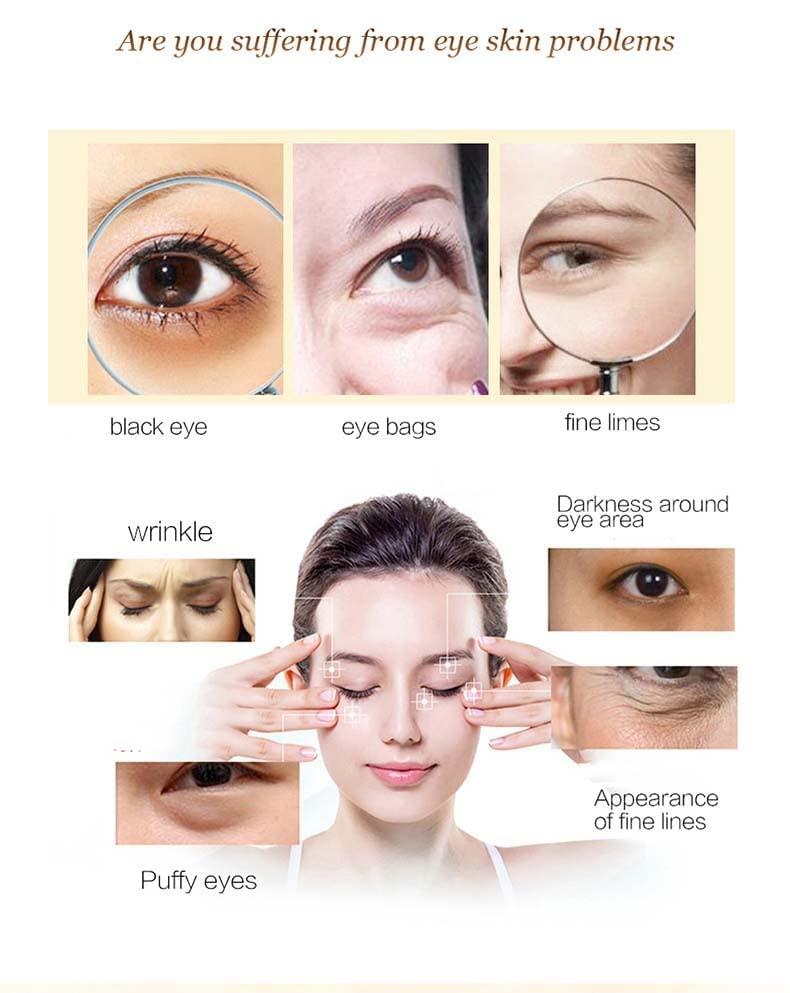 YIXIXI Hyaluronic Acid Eye Gel Patches Reduce Dark Circles, Eye Bags