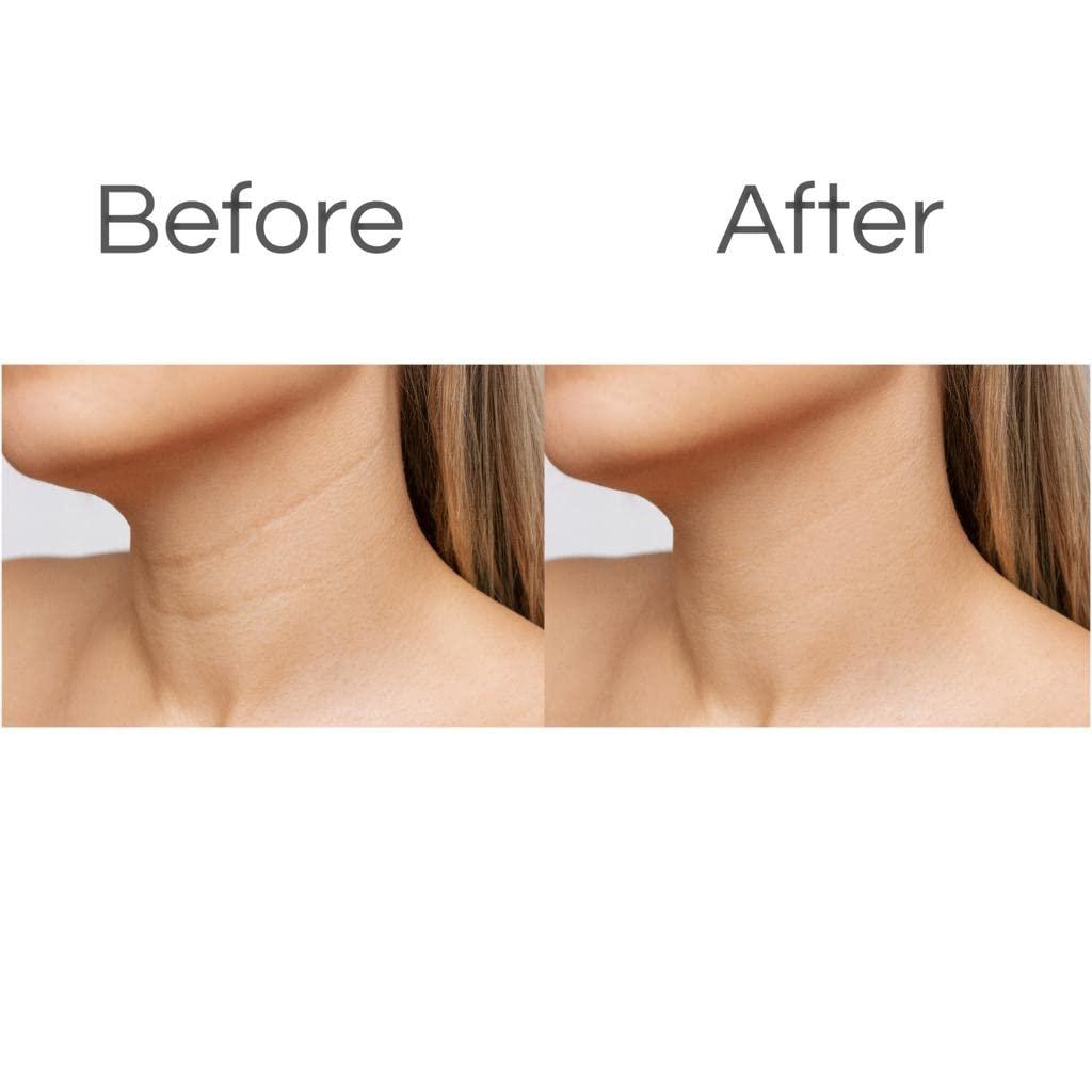 AntiAging Silicone Neck & Chest Wrinkle Patches Skin Firming