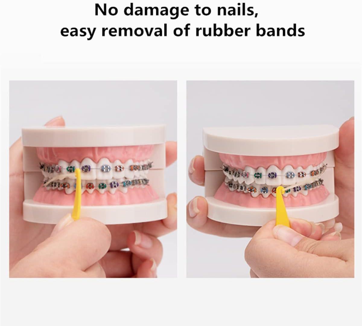 30 Pcs Multicolored Dental Elastic Rubber Bands Placers for Braces