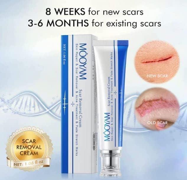 SPEC New Tamoskiny Scar Removal Cream Acne Scar Cream Rapid Repair Scar