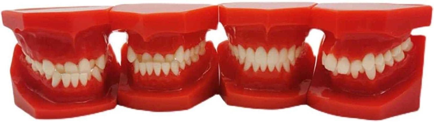 Teeth Educational Model - Orthodontic Classification & Lesson Model for ...