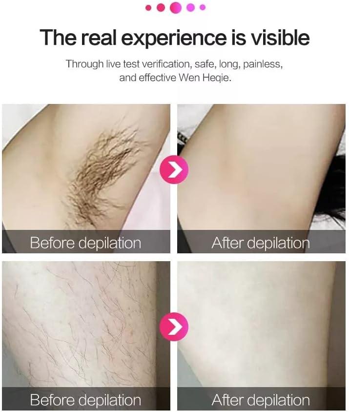 Laser Hair Removal for Women - Permanent Painless IPL Device