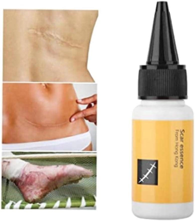 Scar Treatment Serum for Delicate Skin - Acne Scar Removal Cream Scar  Repair & Healing Essence - 20ml