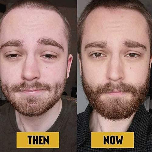 The Beard Club Beard Growth Oil Promote a Healthy Full Beard and