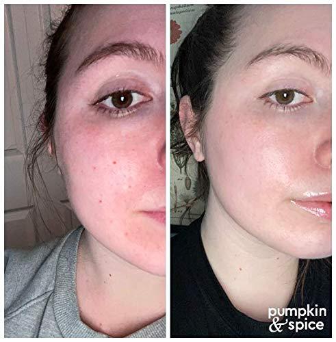 Pumpkin Spice Clay EnzymeMask Removes Pimples Pore Minimizer