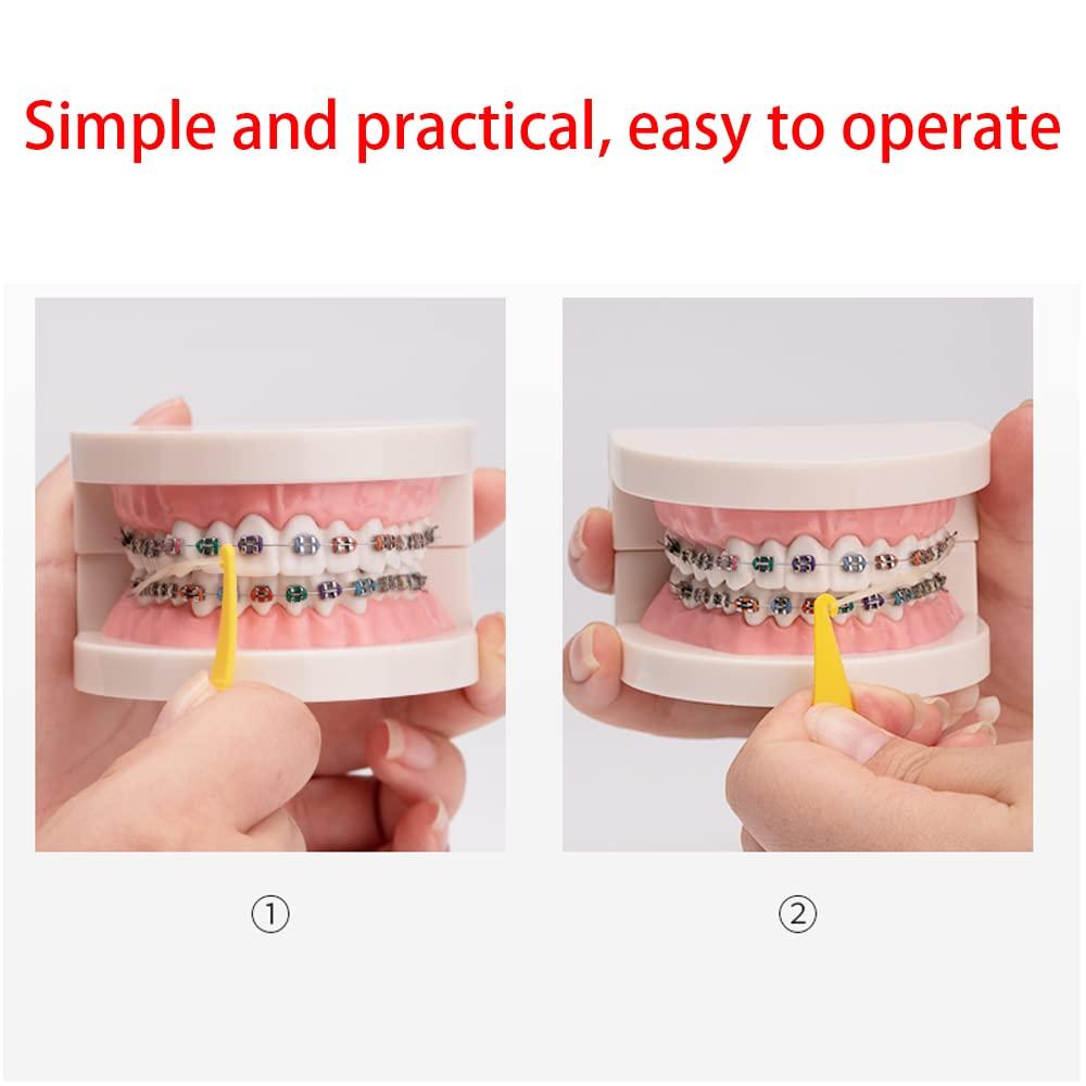 40 pcs Aligner Removal Tool + Braces Rubber Band Tool + Interdental