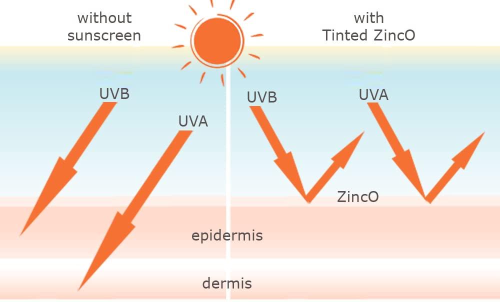 TINTED ZincO SPF 20 Sunscreen Moisturizer for rosacea (2 oz)