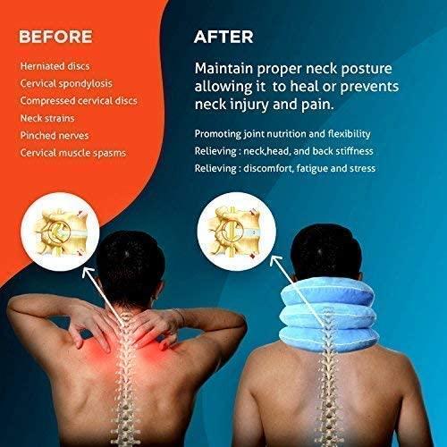 NeckFix Cervical Neck Traction Device for Instant Neck Pain Relief Pinched Nerve Neck