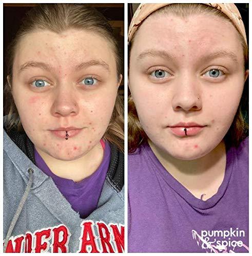 Pumpkin Spice Clay EnzymeMask 3 5 oz Pore Minimizer Acne