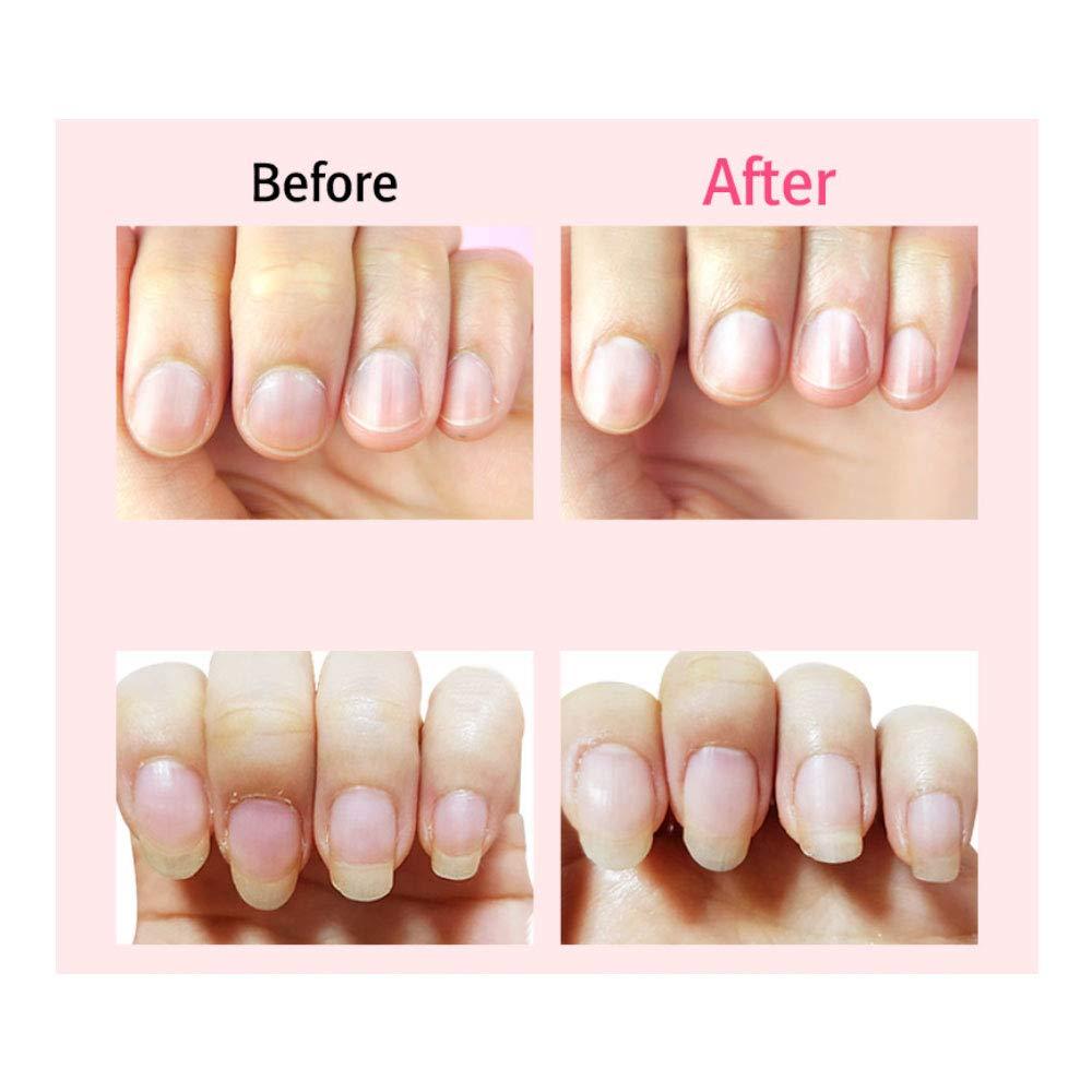 Miracle Finger Toe Nail Cuticle Remover Oil Pusher Cleaner