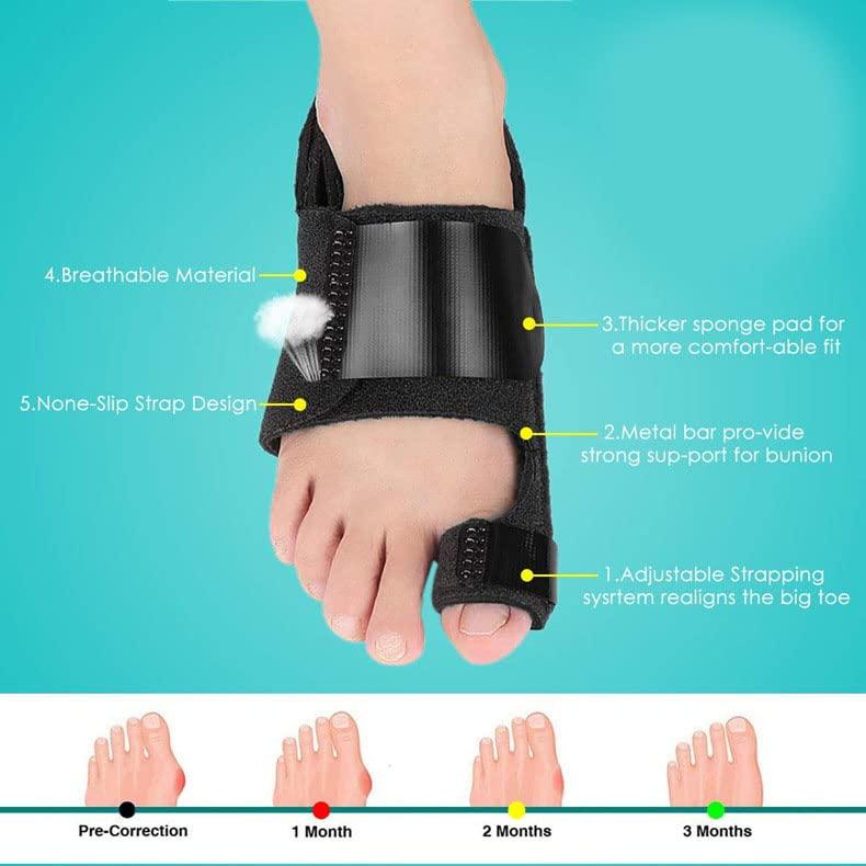 Nuyptcy Bunion Corrector for Women and Men 7PCS Bunion Splint and