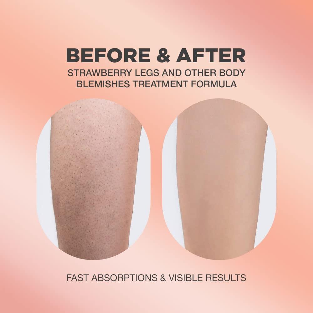 Strawberry Legs Treatment Exfoliating Scrub Wash KP Bump Eraser