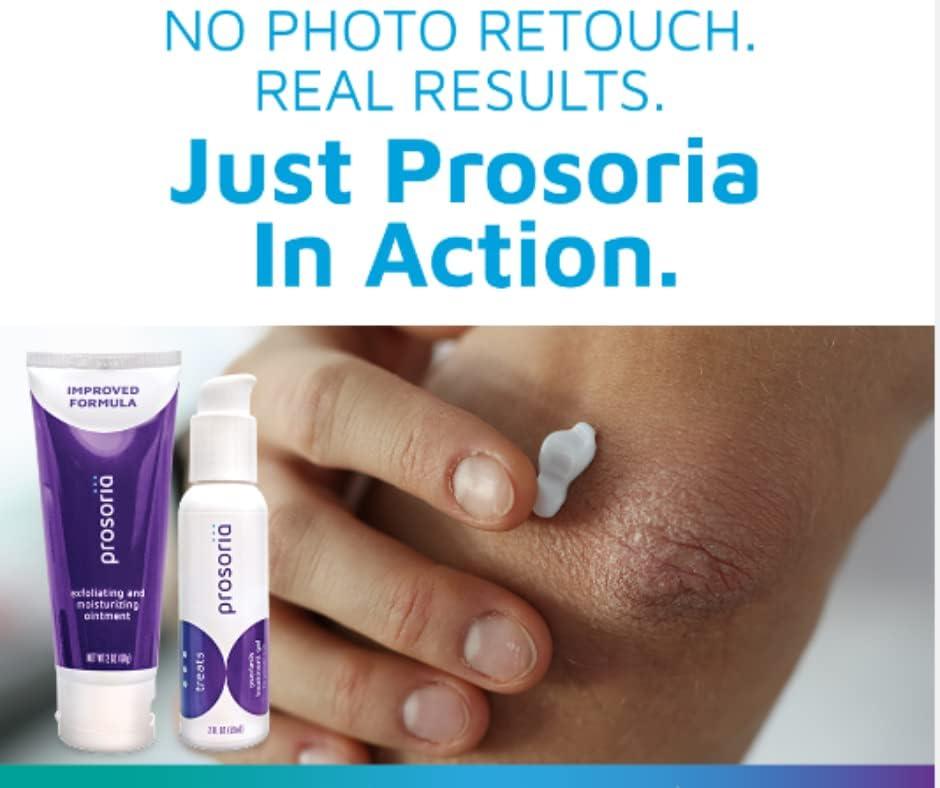 Prosoria Psoriasis Treatment System - Clinical Strength with Natural ...