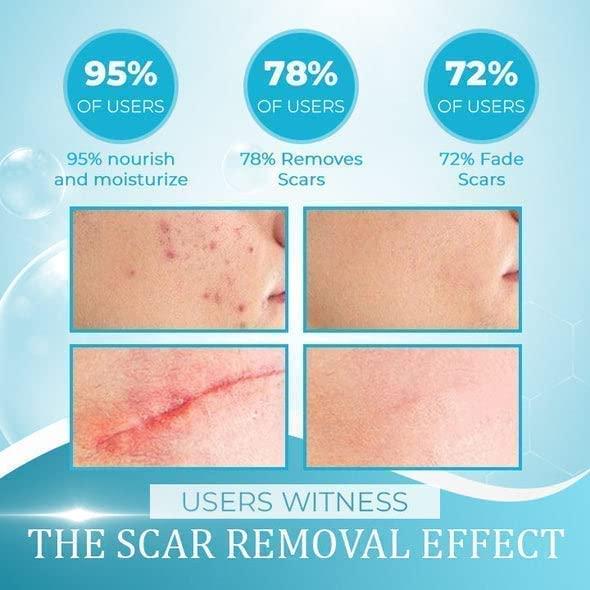 PICKX Organic Scar Removing Gel Keloid & Surgical Scar Removal Cream