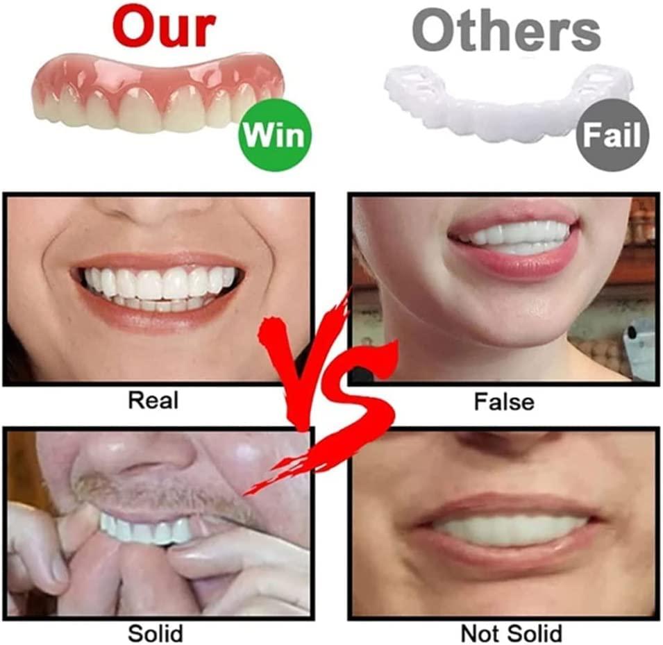 Women's Realistic Veneers Teeth Upper and Lower Dentures for Missing