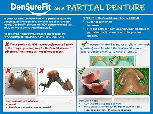 Compare Denture Adhesives to DenSureFit - DenSureFit
