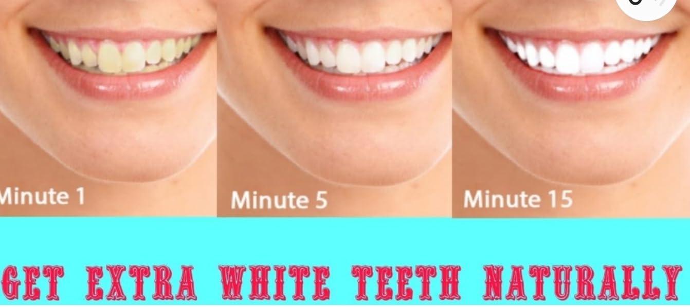 4 x Teeth Whitening Mouth Trays Shields Gum Moulds Remouldable.