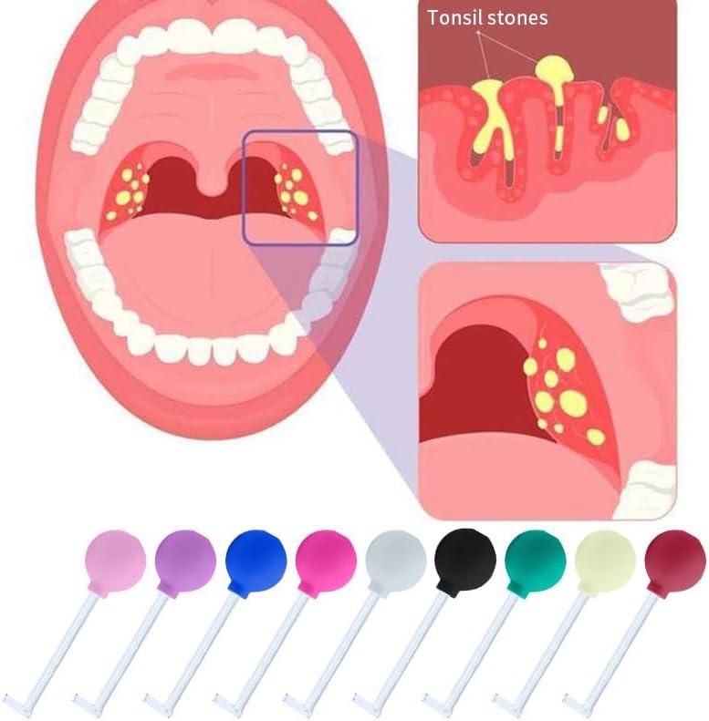 Tonsil Stone Remover Vacuum Tool Vacuum Tool for Removing Tonsils