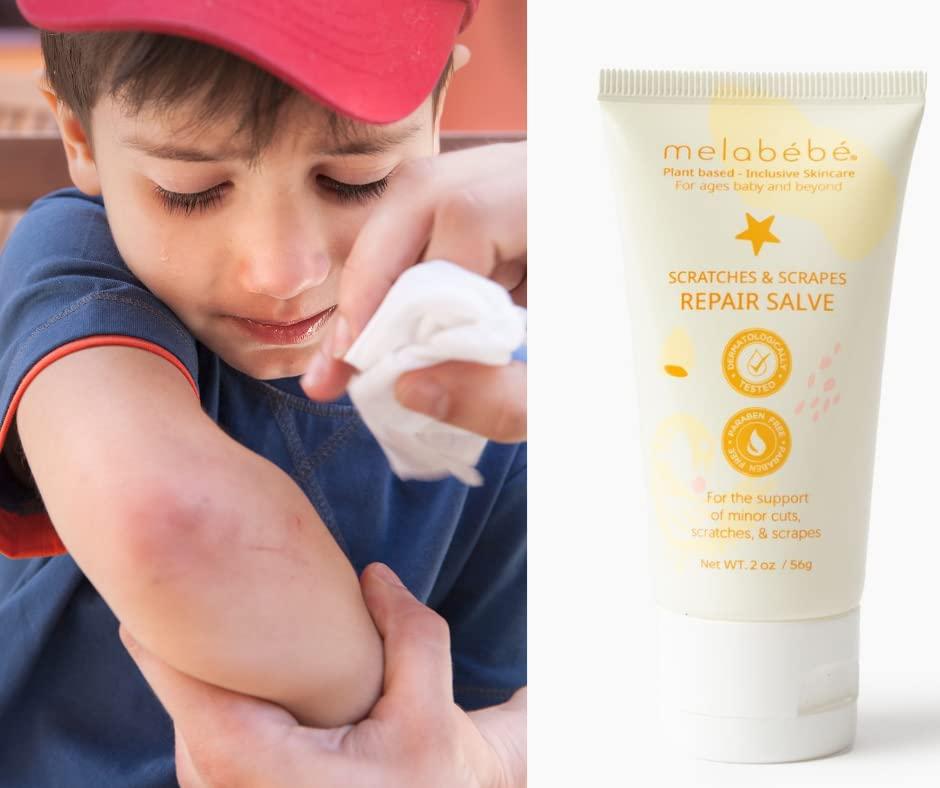 PlantBased Skin Repair Salve for Babies & Beyond Reduce Scars