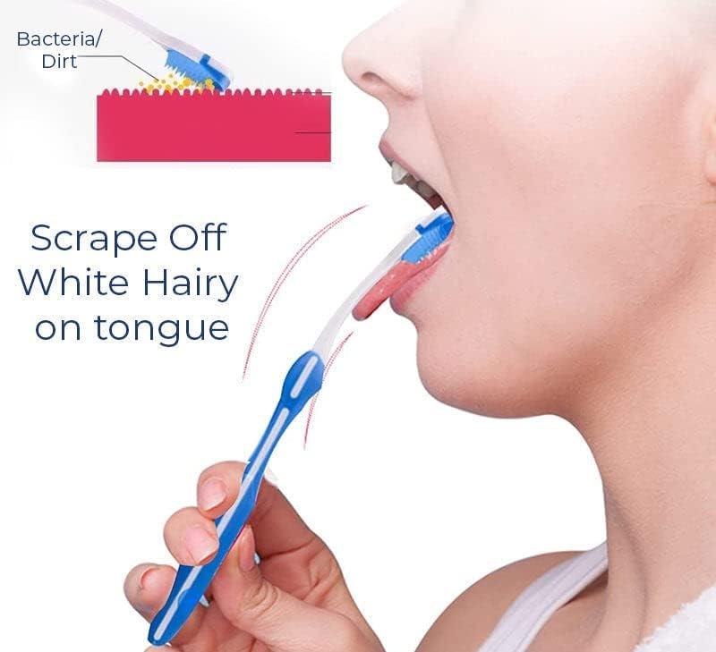 Canada White Hairy Tongue Removal Kit White Hairy Tongue Removal Kit