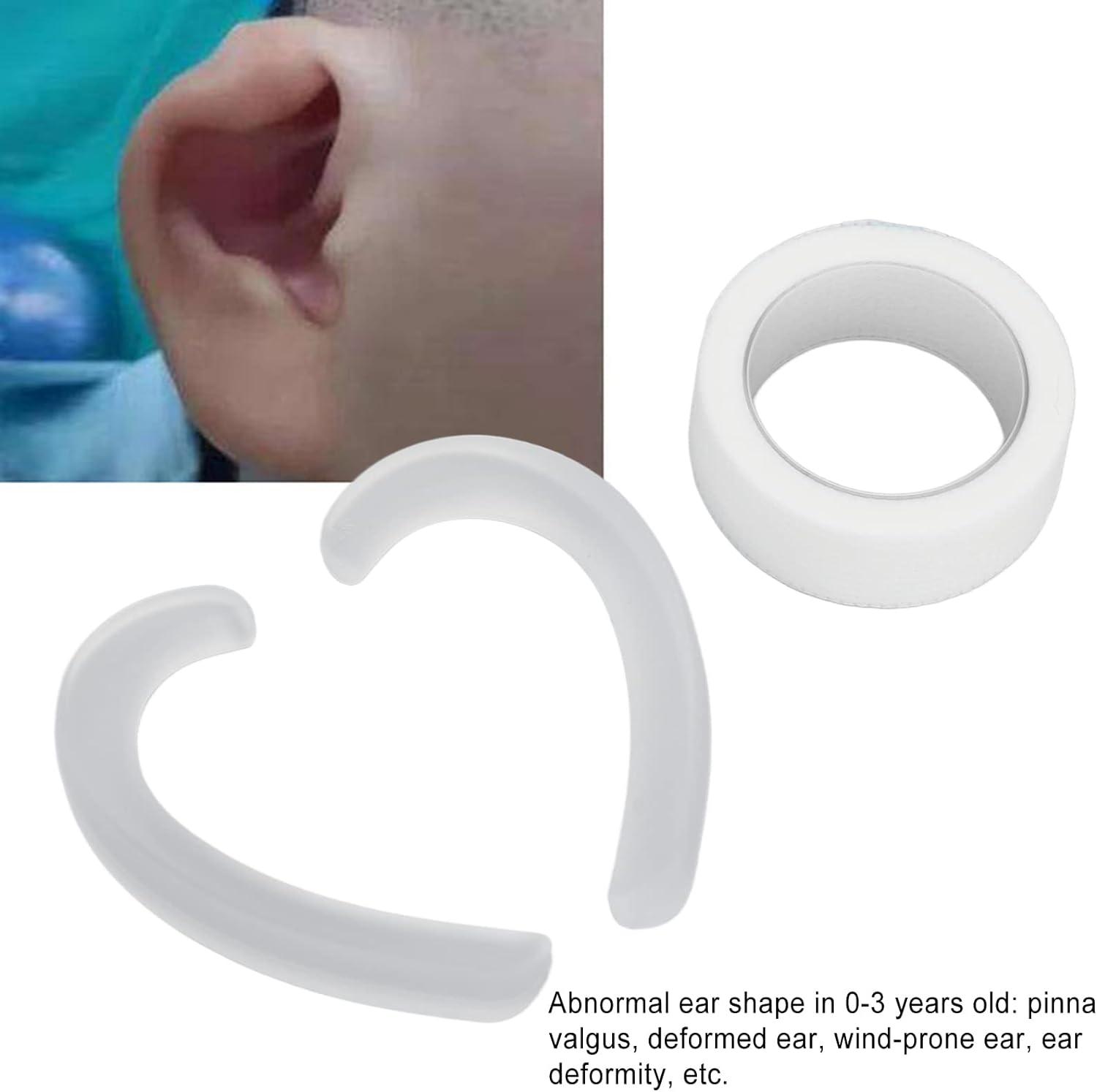 Infant Ear Corrector Baby Ear Tape with Locator Ear Aesthetic