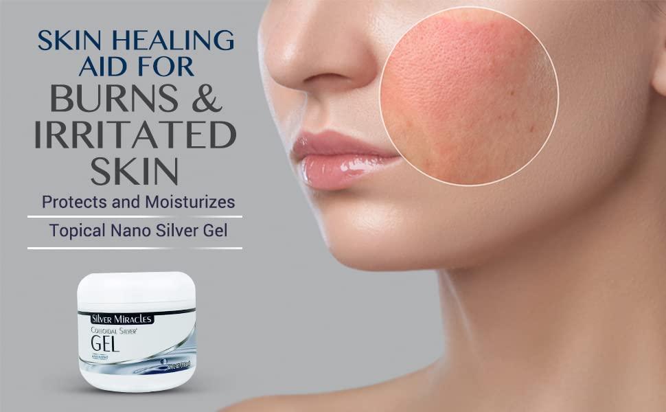 Silver Miracles Colloidal Silver Gel 4oz Sooths and Cools Burns