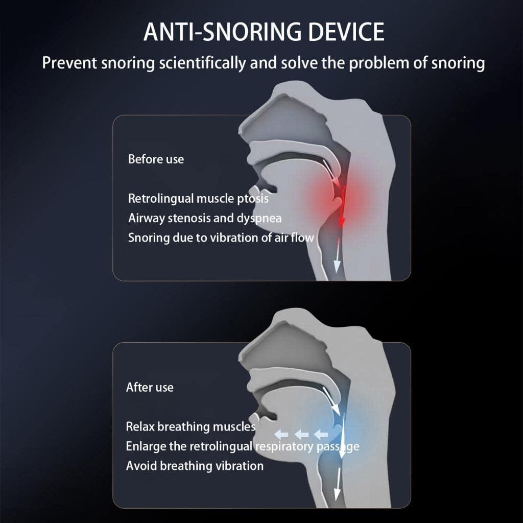 Sleep Aid, Anti-snoring Device main image 0