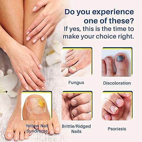 Pulchra Nail Fungus Treatment, Fingernails and Toenails Care Solution