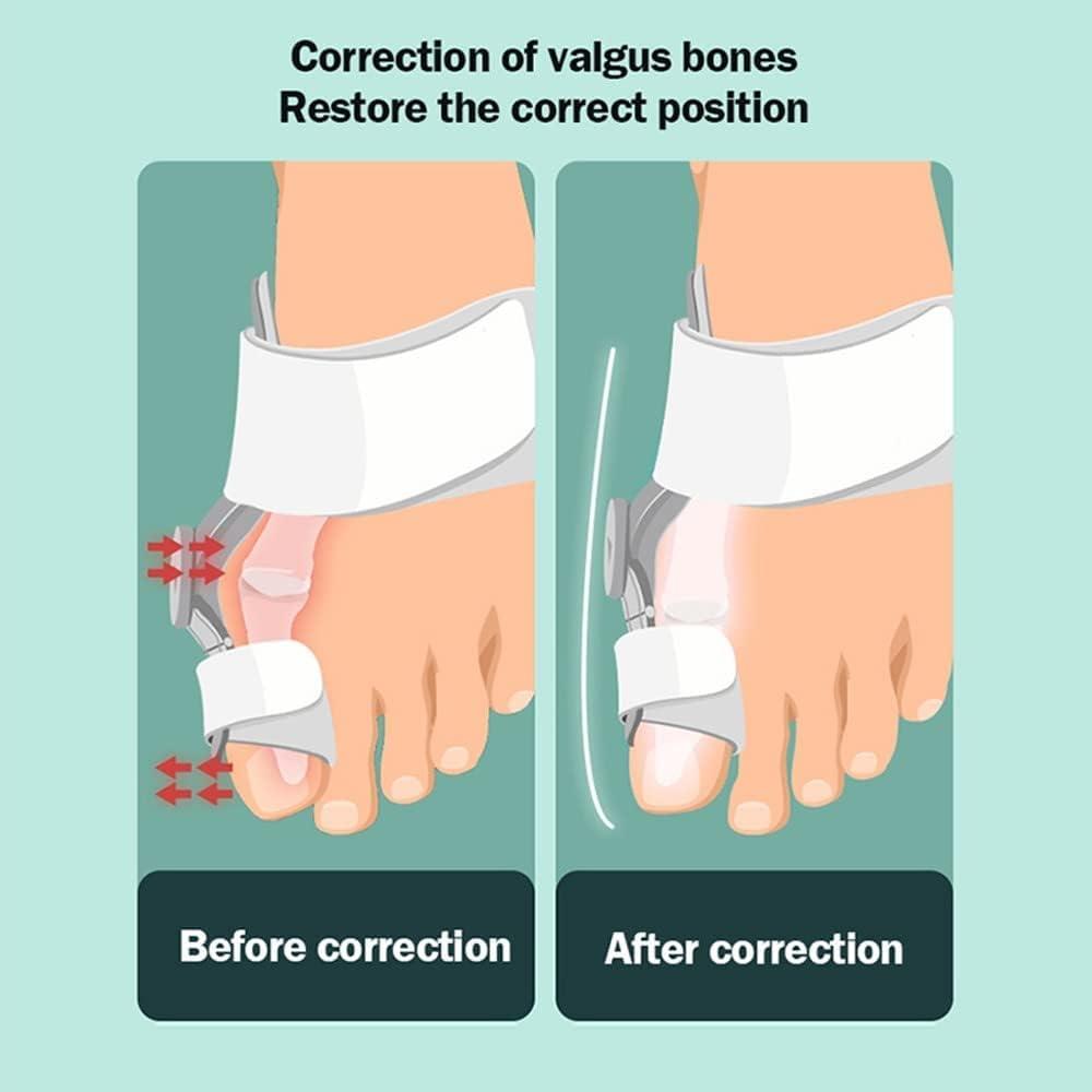 ZARADU Bunion Corrector Big Toe Bunion Straighteners Free Angle
