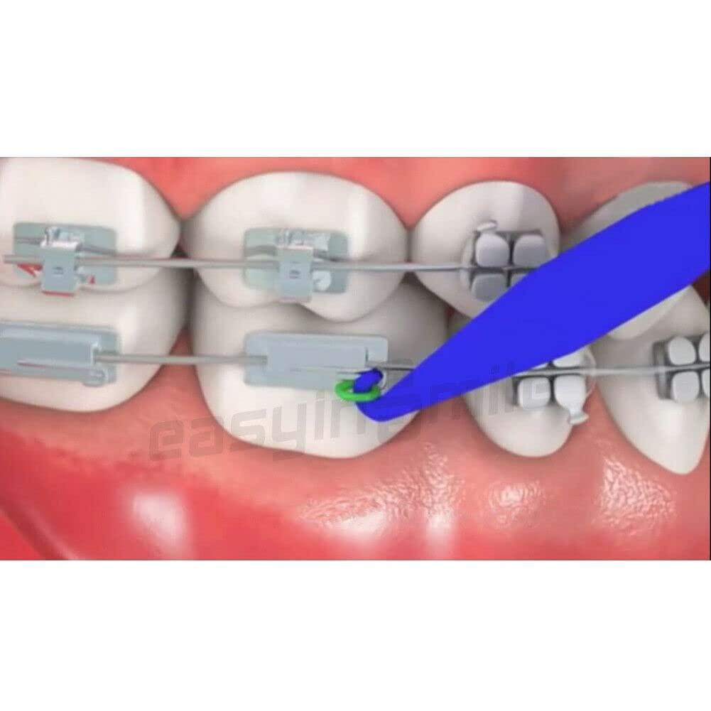 Disposable Dental Elastic Rubber Band Placers for Braces 10PCS