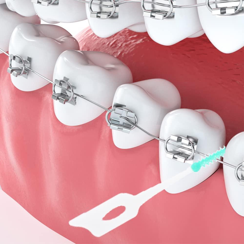 40 pcs Aligner Removal Tool + Braces Rubber Band Tool + Interdental