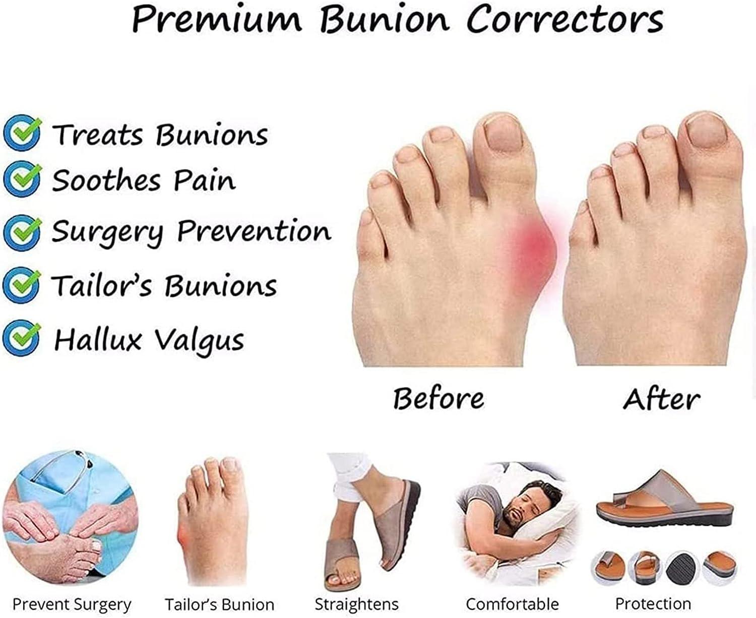 Bunion fixing sandals deals