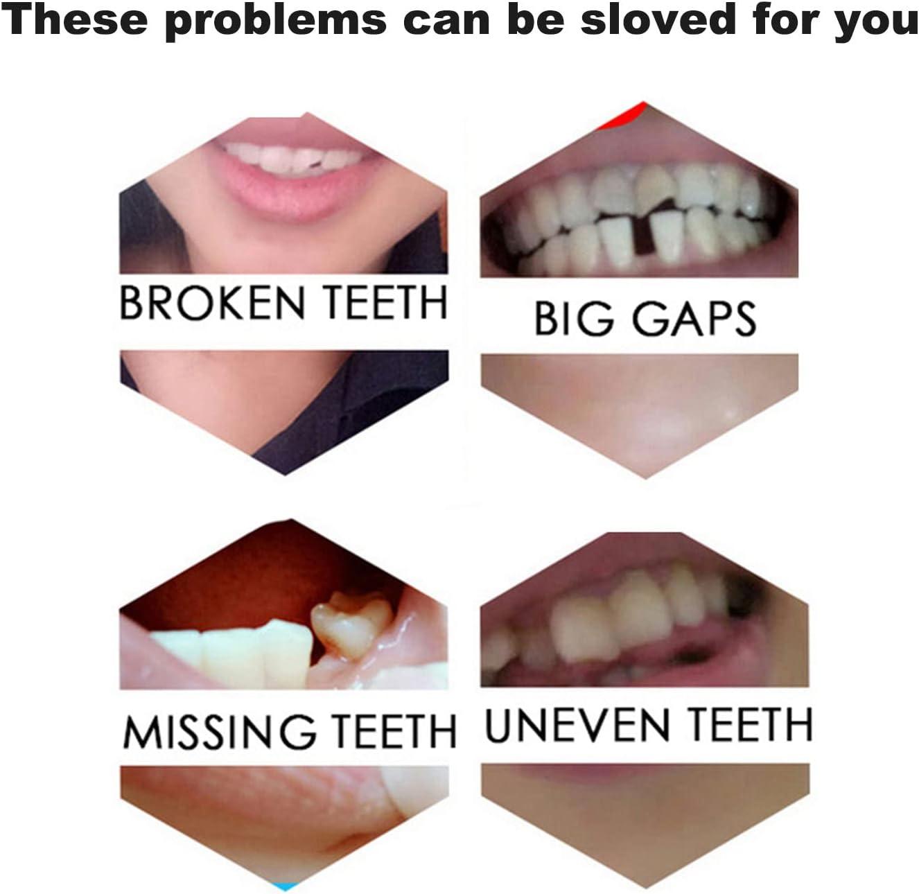 Tooth Repair Kit-Temporary Fixing Irregular & Deformity Teeth or Missing  and Broken Tooth Fake Teeth with Instant Snapping Veneers Smile Adhesive  The Denture Fake Teeth