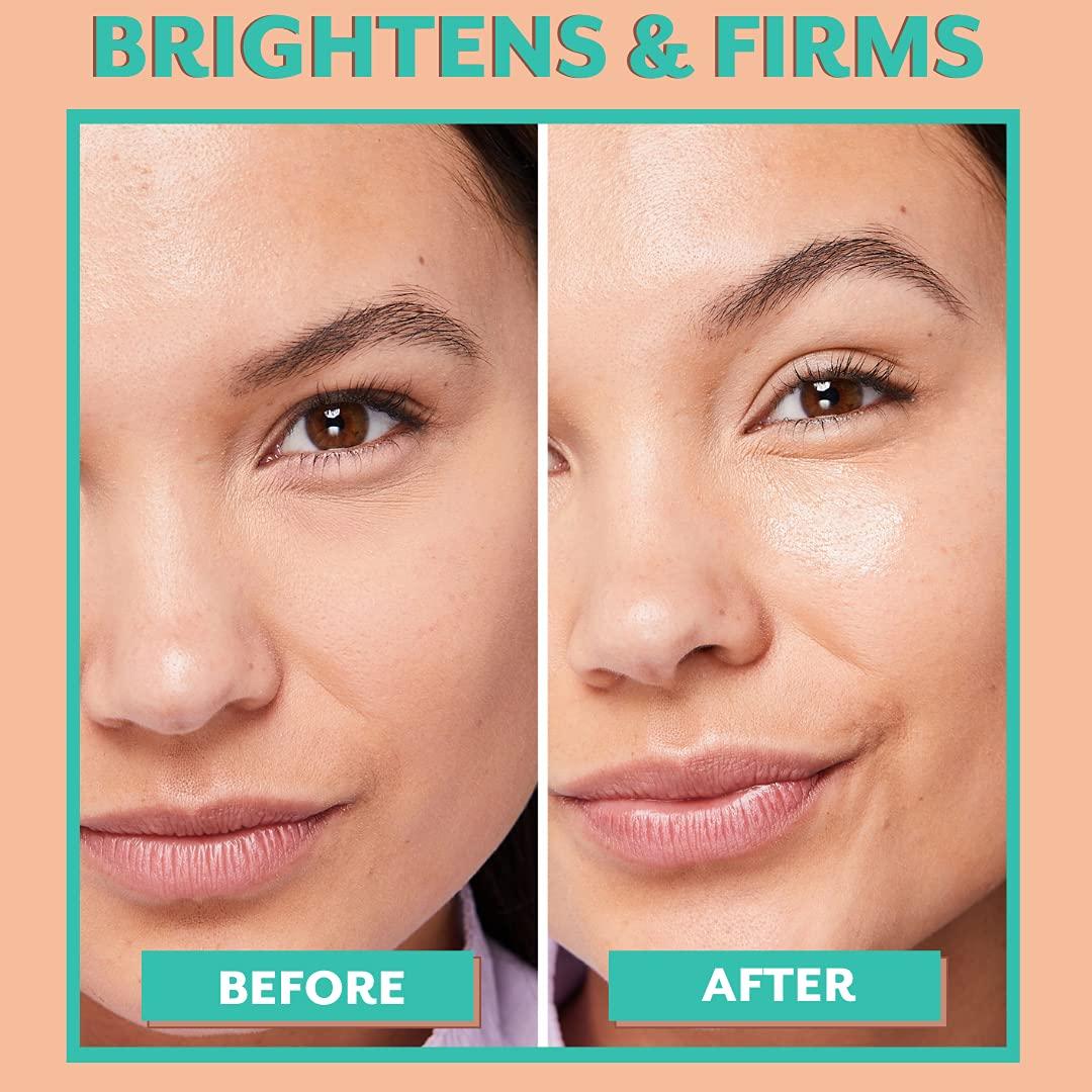 Patchology Serve Chilled Bubbly Eye Gels with Niacinamide Hydrating